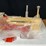 1/16-case-1030-precision-nib-ertl-image-12