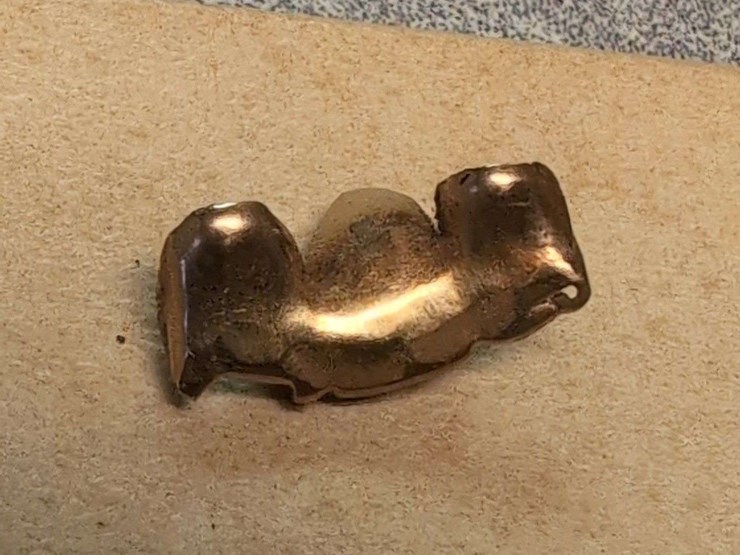 10k-gold-cameo-ring-with-gold-dental-bridge-image-5