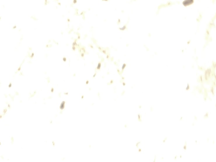 1994-international-2574-image-28