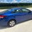 2017-kia-forte-4-door-sedan-(174,799-miles)-image-3