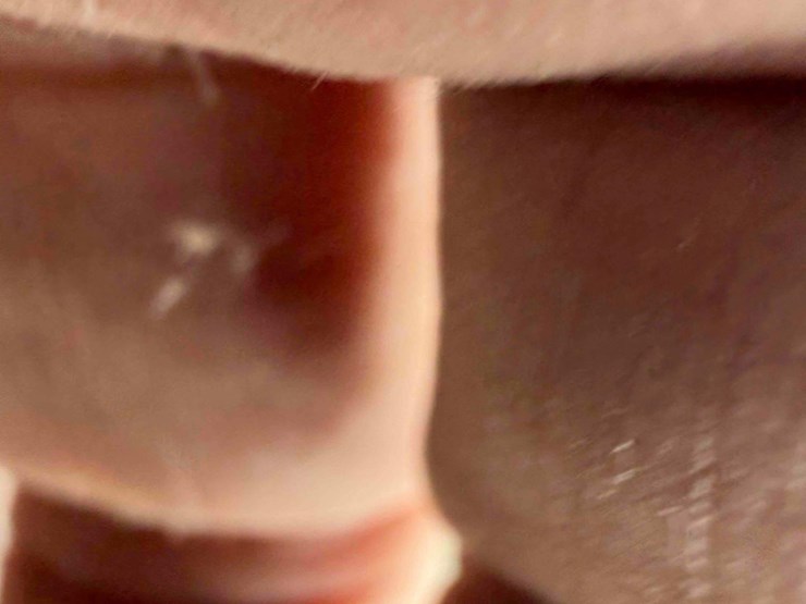 orthman-797-image-26